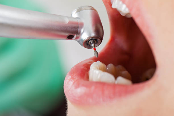 Best Urgent Dental Care in Oakdale, LA